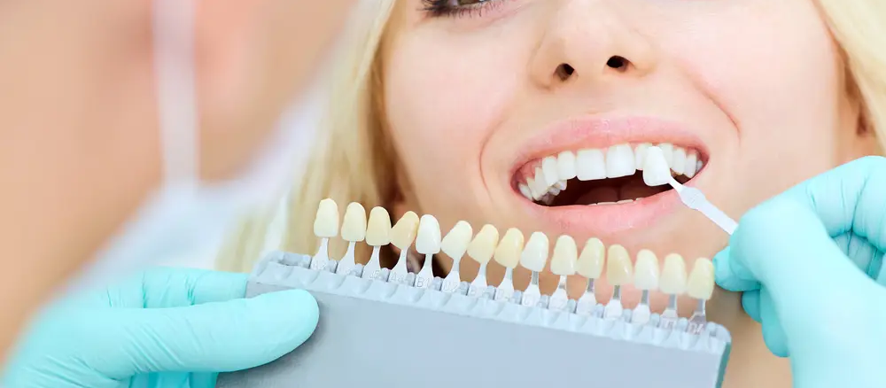 How To Choose The Right Dental Implants